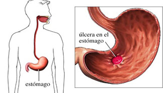 Informe Digital